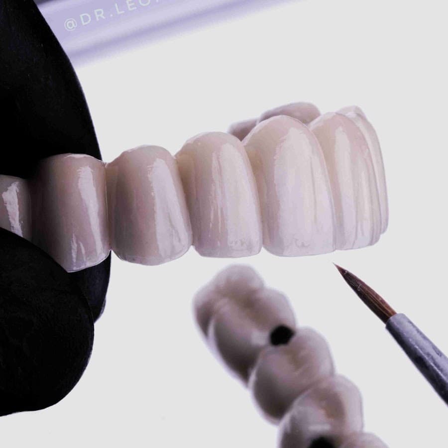 Imagem de close de dentes artificiais sendo pintados, com foco em detalhes.